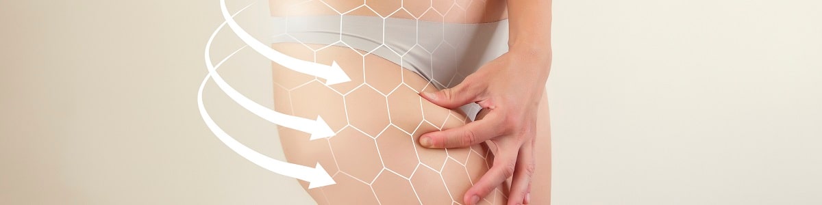 Webinar sobre el Rol del Ejercicio Físico en el Tratamiento de la Celulitis